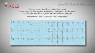 ACLS Megacode Series Video 5 by ACLS Certification Institute [upl. by Nosyt]