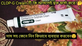 ClopG Cream এর কাজ কিদাম সহ জেনে নিন ব্যবহার করার নিয়ম  ফর্সা হওয়ার ক্রিম  ClopG Cream Review [upl. by Ordnasil]