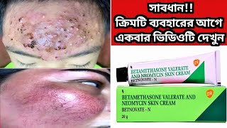 Betnovate n skin cream  বেটনোভেট এন ক্রিম এর কাজ কি ত্বক ফর্সাকারী ক্রিম  Betnovate N Cream [upl. by Ominorej]