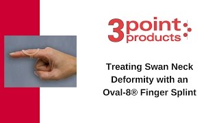 How to Treat Swan Neck Deformity with an Oval8 Finger Splint  3Point Products [upl. by Kursh29]