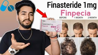 Finpecia Finasteride 1mg Review  Finpecia Side Effects [upl. by Bopp]