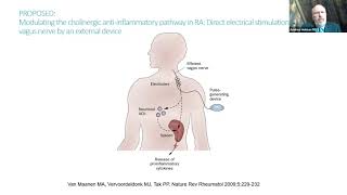 UW Rheumatology Grand Rounds  Andrew Holman 11122024 [upl. by Ternan12]