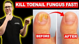 1 BEST Toenail Fungus Treatment Top 10 Home Remedies 2024 [upl. by Sset934]