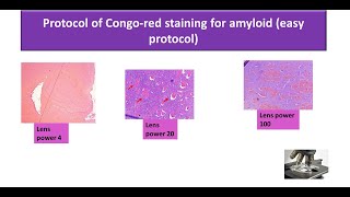 Congo red staining for amyloid easy protocol [upl. by Soloma]