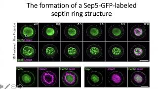 Dissecting the Cellular Control of Septin Organization in a Global Cereal Killer [upl. by Gearard522]