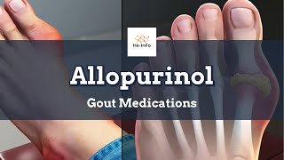 allopurinol  Uses Dosage Side Effects amp Mechanism  Aloprim [upl. by Asim]