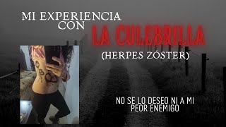 Mi HORRIBLE experiencia con la CULEBRILLA herpes zóster  ¡Me dolía hasta el roce de la remera [upl. by Buddie]