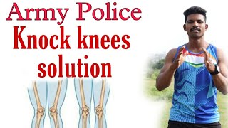 knock knee problem solution  knock knees  knock knee army exercise knock knee  mahesh awhale [upl. by Normie]