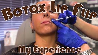 Getting a Botox Lip Flip  My Honest Experience  Before amp After  Botox Injection Footage [upl. by Yaras]