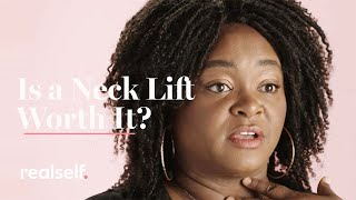 Is a Neck Lift Worth It Everything You Need to Know About the Surgery [upl. by Nelyaw]