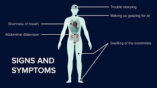 What is Heart Failure Causes Symptoms and Treatment [upl. by Salangia823]