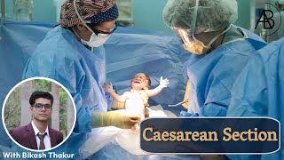 Caesarean Section  All you need to know  Caesarean Birth  Pregnancy  Obstetrics  Csection [upl. by Lorene]