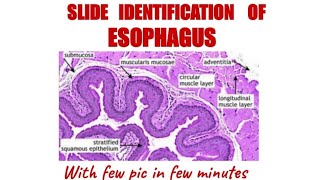 ESOPHAGUS HISTOLOGYIdentification points [upl. by Swamy]