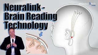 Elon Musks Neuralink  Brain Reading Technology  Quick Bytes [upl. by Kamaria778]