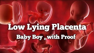 Low Lying Placenta💖Placenta position really predict the Baby Gender💖Baby Boy scan reports proof [upl. by Cilka351]