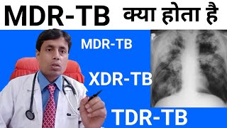 MDRTB  XDRTB TDRTB  MDR TB kya hota hai  DrSanjaychestSpecialist [upl. by Talanian]