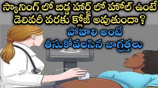 heart hole during pregnancy telugu [upl. by Anaili31]