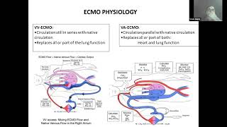 01 Ventilation strategy during ECMO by Dr Vivek Gupta ECMO INDIA OCT 2024  Day 02 [upl. by Janis]