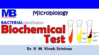 BIOCHEMICAL TEST  Bacterial Identification Technique  Microbiology  Vivek Srinivas Bacteriology [upl. by Hirasuna720]