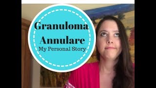 Granuloma Annulare My Story [upl. by Judenberg]