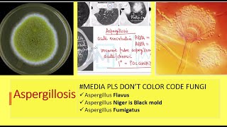 Yellow fungus  Aspergillus Flavus  Aspergillosis by Dr Marwah [upl. by Ferwerda641]