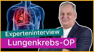 Behandlung von Lungenkrebs  minimal invasiv oder offen  Asklepios [upl. by Attirehs746]