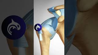 Shoulder Subluxation vs Shoulder Dislocation  Shohei Ohtani Shoulder Injury in 3D animation [upl. by Helmer118]