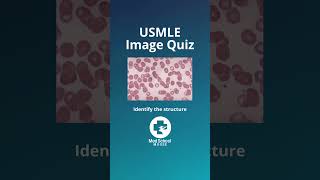 ⬆️More high yield USMLE here  📌Answer in comments usmle usmlestep1 medstudent medschool shorts [upl. by Neehahs995]