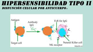 TIPOS DE HIPERSENSIBILIDAD [upl. by Persis]