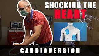 Atrial Fibrillation  Shocking The Heart Into Normal Rhythm With DC Cardioversion [upl. by Gregson]