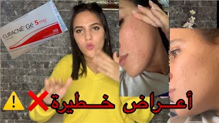 CURACNE تجربتي مع كوراكني ،أعراض و نصائح [upl. by Ernaldus]