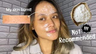 I tried to use baking soda as my acne spot treatment and this is what happen ⎮English⎮65 [upl. by Ayrad]