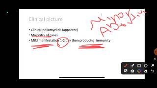 L14 Poliomyelitis COM41 [upl. by Oballa]