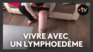 Vivre avec une maladie orpheline  le lymphœdème [upl. by Bisset502]