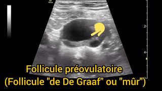 Ovaire normal Follicule de De Graaf Follicule préovulatoire ou mûr Échographie [upl. by Brawner]