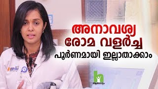 അനാവശ്യ രോമ വളർച്ച പൂർണമായും ഇല്ലാതാക്കാം  Laser Hair Removal Malayalam Health Tips [upl. by Terti863]