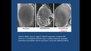 Surgery in the Care of Medullary Thyroid Cancer [upl. by Obara]