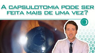 O YAG laser pode ser repetido [upl. by Alicia]