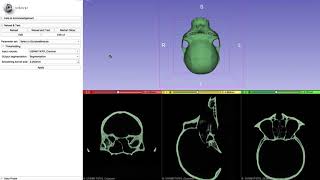 Segmenting Endocranial cavity and making an endocast [upl. by Wall730]