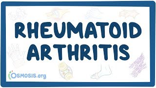 Rheumatoid arthritis  causes symptoms diagnosis treatment pathology [upl. by Anes]