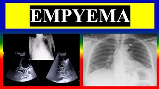 EMPYEMA  define  factors  pathophysiology  clinical  diagnostic  management [upl. by Ajup]