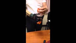 3D printed Body powered Prosthesis GalileoHand  Patient test [upl. by Ace311]