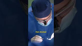 Liposuction DISASTER That SHOCKED The World shorts medicalstories horrorstories [upl. by Nosinned]