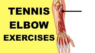 Tennis Elbow Exercises amp Stretches Lateral Epicondylitis Supinator Muscle [upl. by Xyla731]