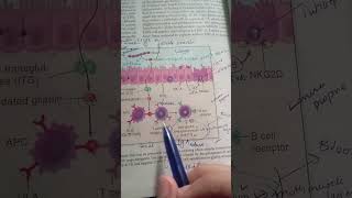 Pathogenesis of Celiac Disease  Robbin  Pathology [upl. by Odla519]