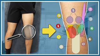 Pain in the back of your knee explained  10 most common causes and solutions [upl. by Nollat701]