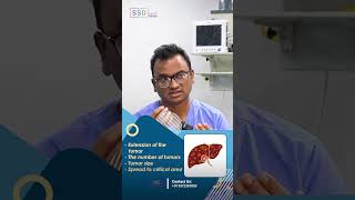 Liver Metastasis from Colon amp Rectal Cancer Available Treatment Options  Dr Praveen Kammar [upl. by Ohs]