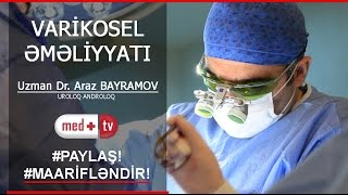 VARIKOSEL EMELIYYATI TAM IZLE  Uzman Dr Araz BAYRAMOV Uroloq Androloq Medplus TV [upl. by Schulze]