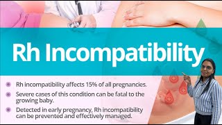 RH incompatibility jaundice [upl. by Adlaremse]