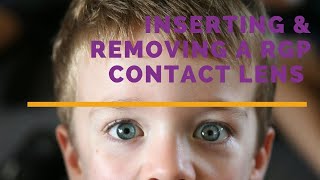 Inserting and removing a contact lens in a child [upl. by Pamela696]